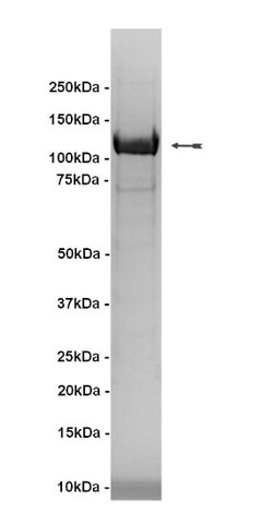 Eurofins DiscoverX IKK Protein, Active 10 &mu;g | Buy Online | Eurofins DiscoverX | Fisher Scientific